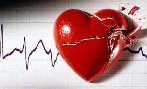 ¿Se pueden predecir los ataques al corazón?  Ataques-al-corazc3b3n1